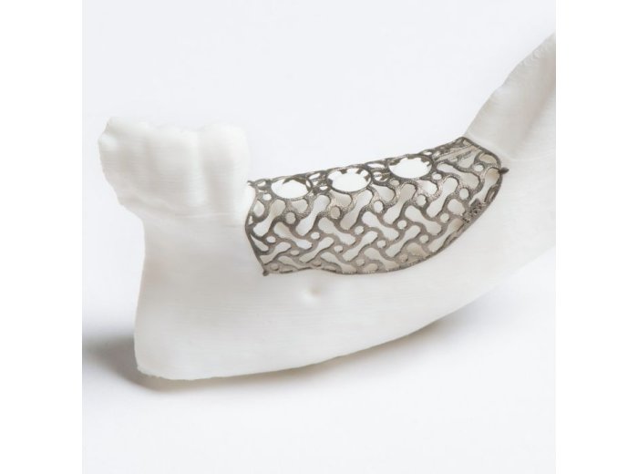 Malla de titanio preformada 100×100 mm