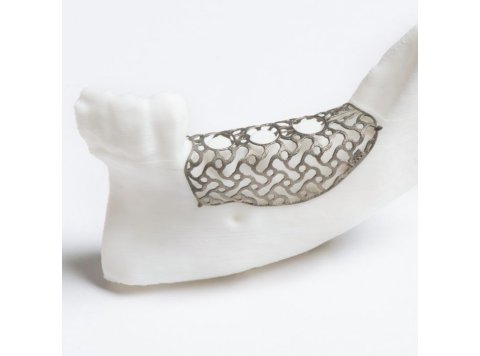 Malla de titanio preformada 100×100 mm